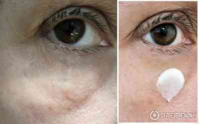 Либридерм лосьон для снятия макияжа с глаз отзывы
